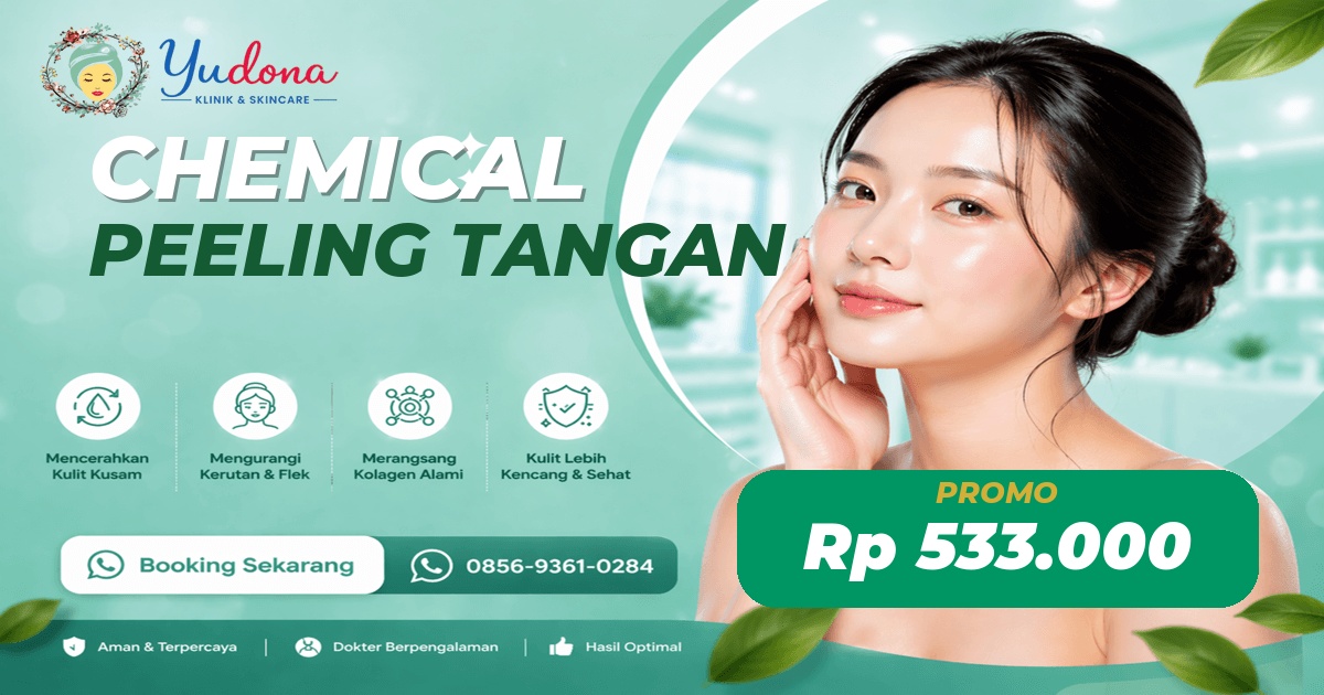 Chemical Peeling Tangan di Cibinong, Bogor