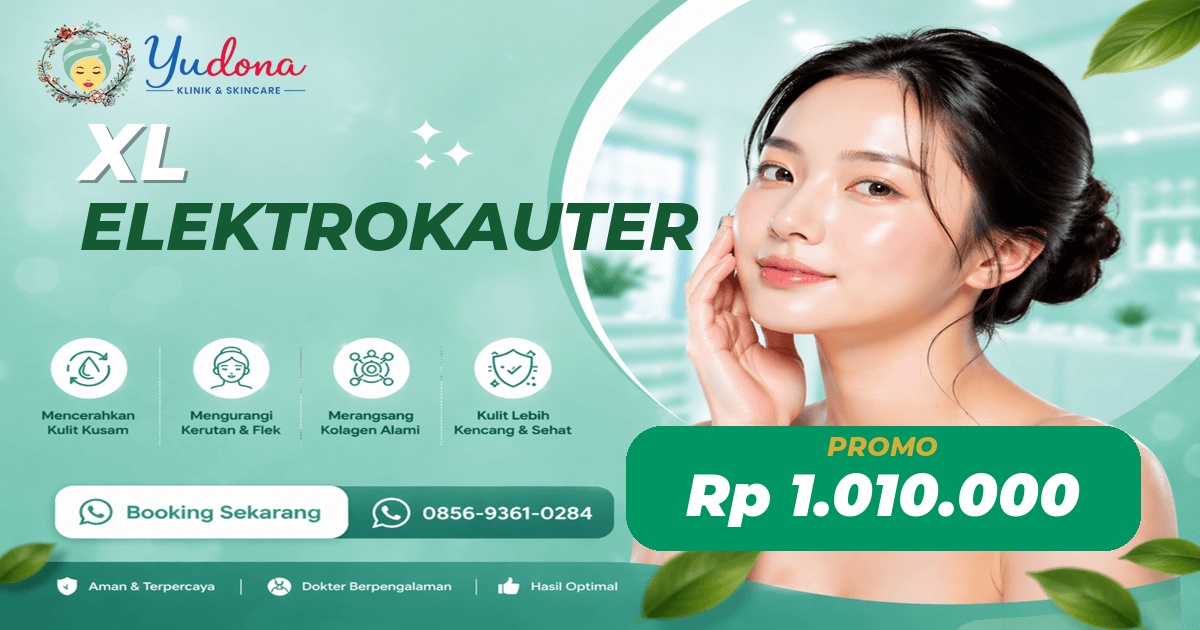 Elektrokauter XL di Cibinong, Bogor