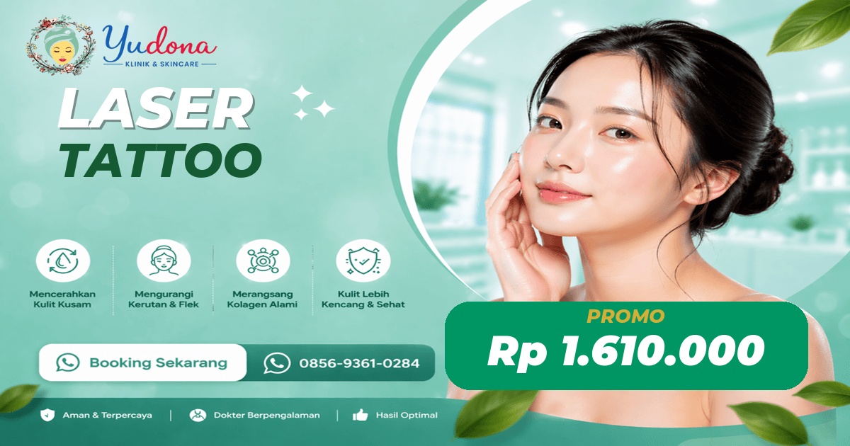 Laser Tattoo di Cibinong, Bogor