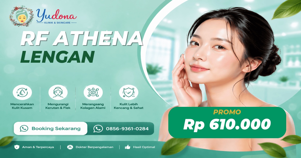 RF Athena Lengan di Cibinong, Bogor